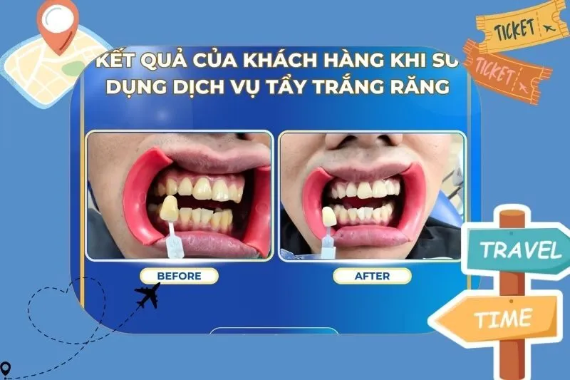 Nha Khoa Quốc Tế Việt Úc